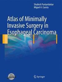 bokomslag Atlas of Minimally Invasive Surgery in Esophageal Carcinoma