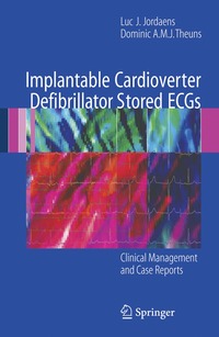 bokomslag Implantable Cardioverter Defibrillator Stored ECGs