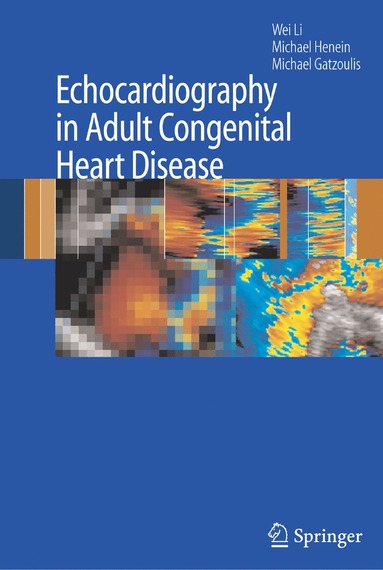 bokomslag Echocardiography in Adult Congenital Heart Disease