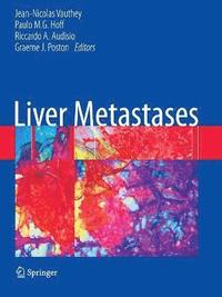 bokomslag Liver Metastases