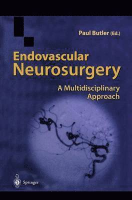 Paul Butler - Endovascular Neurosurgery, Häftad