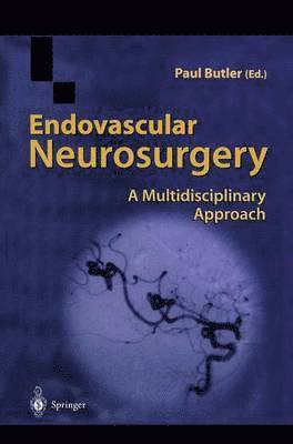 Endovascular Neurosurgery 1