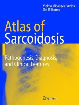 Atlas of Sarcoidosis 1