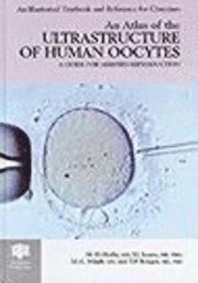 bokomslag An Atlas of the Ultrastructure of Normal, Abnormal and Failed Fertilized Human Oocytes