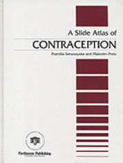 bokomslag A Slide Atlas of Contraception