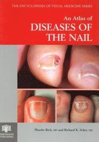 bokomslag An Atlas of Diseases of the Nail