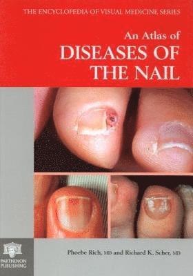 Phoebe Rich, Richard K. Scher - Atlas of Diseases of the Nail, Inbunden