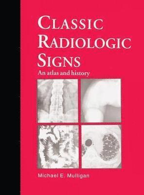 Classic Radiologic Signs 1