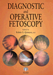 bokomslag Diagnostic and Operative Fetoscopy