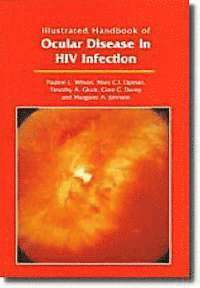 bokomslag Illustrated Handbook of Ocular Disease in HIV Infection