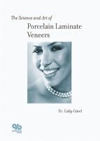 Science and Art of Porcelain Laminate Veneers