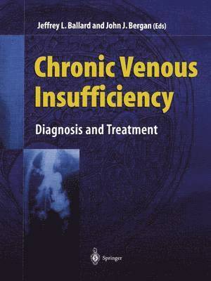 bokomslag Venous Insufficiency