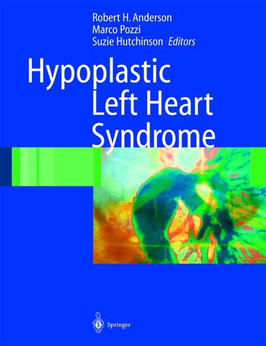 Robert H. Anderson, Marco Pozzi, Suzie Hutchinson - Hypoplastic Left Heart Syndrome, Inbunden