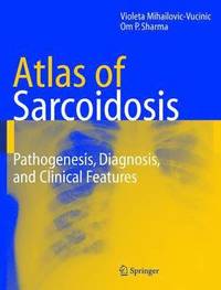 bokomslag Atlas of Sarcoidosis