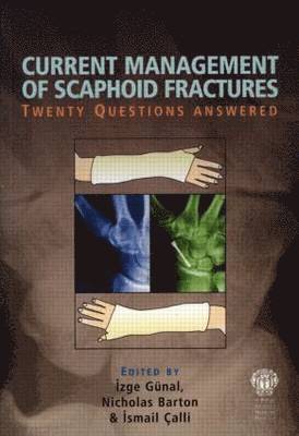 bokomslag Current Management of Scaphoid Fractures