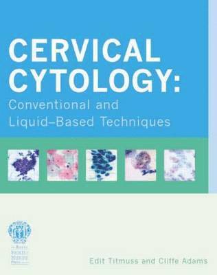 Cervical Cytology: Conventional and Liquid-Based 1