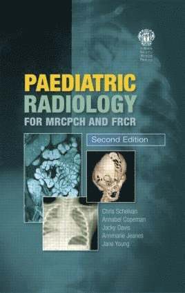 Christopher Schelvan, Copeman Copeman, Christopher Schelvan, Annabel Copeman, Jacqueline Davis, Annmarie Jeanes, Jane Young - Paediatric Radiology for MRCPCH and FRCR, Second Edition, Häftad