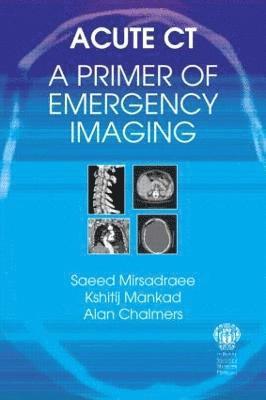 bokomslag Acute CT: A Primer of Emergency Imaging