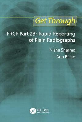 Nisha Sharma, Anu Balan - Get Through Frcr Part 2b: Rapid Reporting of Plain Radiogrpahs, Häftad