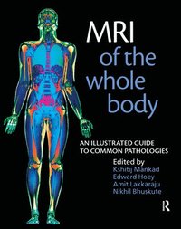 bokomslag MRI of the Whole Body