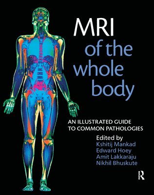 bokomslag MRI of the Whole Body