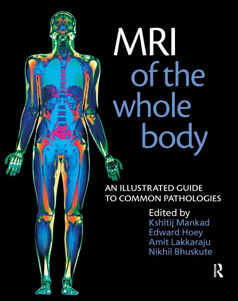 Nikhil Bhuskute, Edward Hoey, Amit Lakkaraju, Kshitij Mankad, UK) Hoey, Edward (Consultant Radiologist, Heart of England NHS Foundation Trust, UK and Honorary Senior Lecturer, University of Birmingham, Australia) Lakkaraju, Amit (Consultant Musculoskeletal Radiologist, Goulburn Valley Base Hospital, Shepparton - MRI of the Whole Body, Häftad