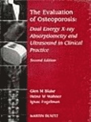 bokomslag The Evaluation of Osteoporosis