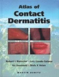 bokomslag An Atlas of Contact Dermatitis