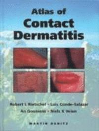 bokomslag An Atlas of Contact Dermatitis