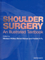 bokomslag Shoulder Surgery