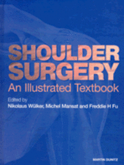 Shoulder Surgery 1