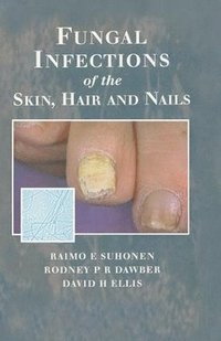 bokomslag Fungal Infections of the Skin and Nails