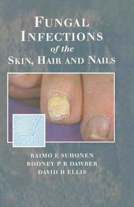 Raimo E. Suhonen, Rodney P.R. Dawber, David H. Ellis, Rodney P. R. Dawber, Raimo E Suhonen, Rodney P R Dawber, David H Ellis - Fungal Infections of the Skin and Nails, Inbunden