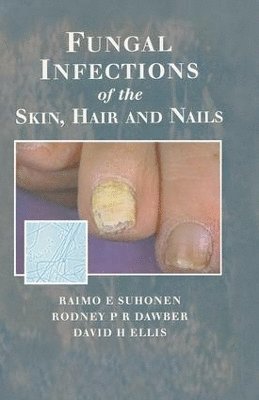 Fungal Infections of the Skin and Nails 1