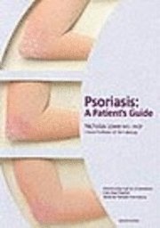 bokomslag Psoriasis