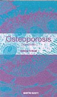 bokomslag Osteoporosis: Pocketbook