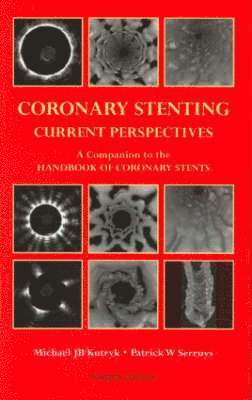 bokomslag Coronary Stenting