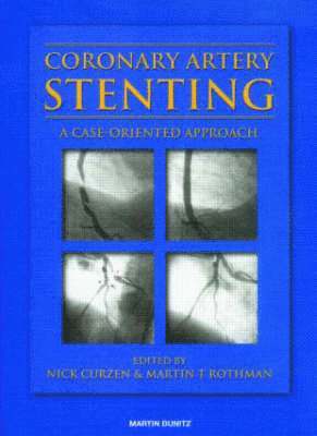 Coronary Artery Stenting 1