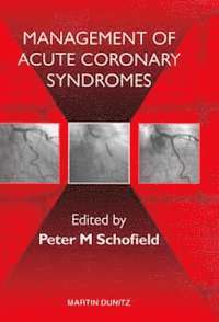 bokomslag The Management of Acute Coronary Syndromes