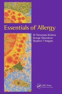 bokomslag Essentials of Allergy