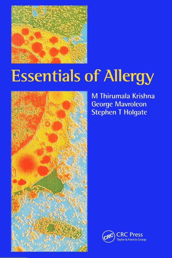 M Thirumala Krishna, George Mavroleon, Stephen T Holgate, M. Thirumala Krishna - Essentials of Allergy, Häftad