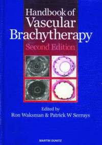 bokomslag Handbook of Vascular Brachytherapy