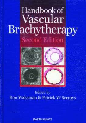Handbook of Vascular Brachytherapy 1