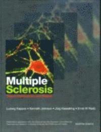 bokomslag Multiple Sclerosis