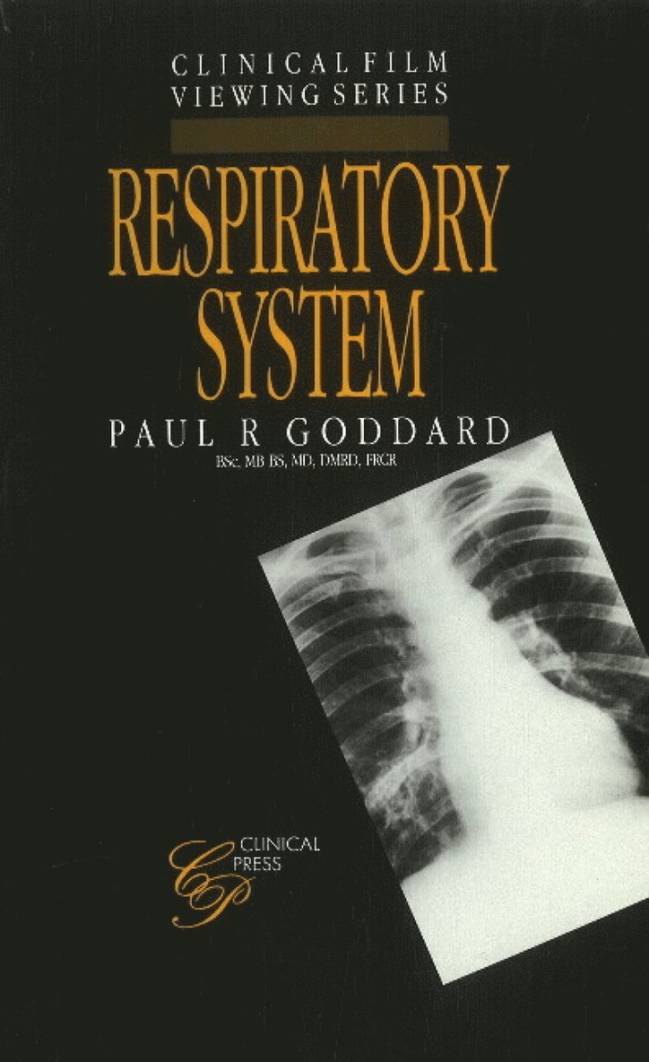 Paul R Goddard, FRCR Goddard, Paul R, BSc, MB BS, MD, DMRD - Respiratory System, Häftad