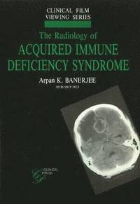 bokomslag Radiology of Acquired Immune Deficiency Syndrome