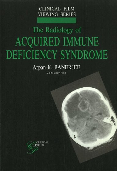 Arpan K Banerjee - Radiology of Acquired Immune Deficiency Syndrome, Häftad