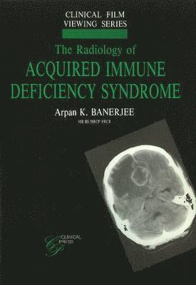 Radiology of Acquired Immune Deficiency Syndrome 1