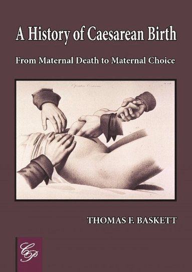 Thomas F Baskett - History of Caesarean Birth, Häftad