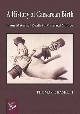 bokomslag History of Caesarean Birth